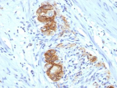 Monoclonal anti CD56 / NCAM (123C3.D5)