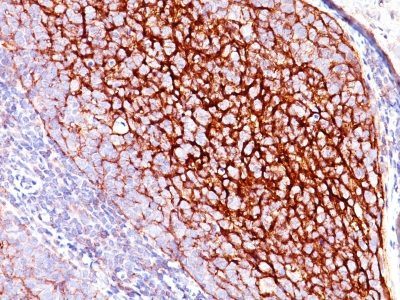 Monoclonal anti CD35 / CR1 (E11)