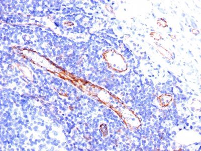 Monoclonal anti CD31 / PECAM 1 (C31.3)