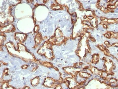 Monoclonal anti CD31 / PECAM 1 (C31.3)