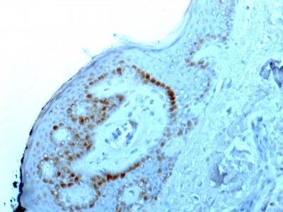 Monoclonal anti Nucleolar / Nucleoli (NM95)