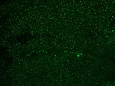 Monoclonal anti Nucleolar / Nucleoli (NM95)