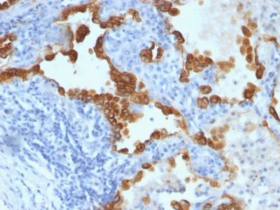 Monoclonal anti Nuclear Membrane (NM97)