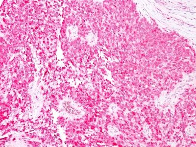 Monoclonal anti S100 (4C4.9)