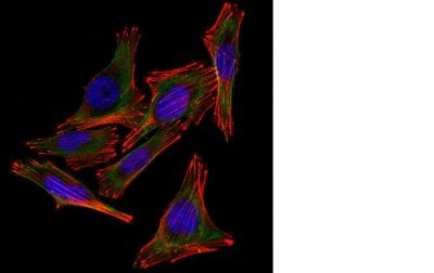 Monoclonal anti S100 (4C4.9)