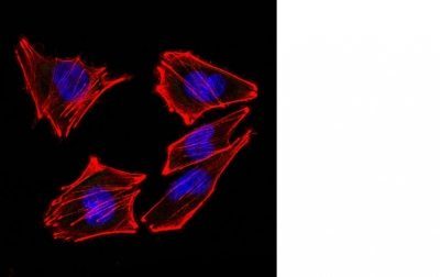 Monoclonal anti S100 (4C4.9)