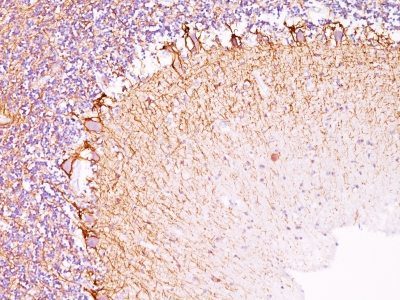 Monoclonal anti Neurofilament (NF L) (NR 4)