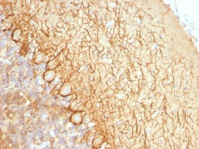 Monoclonal anti Neurofilament (NF L) (NR 4)