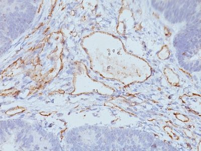 Monoclonal anti CD31 / PECAM 1 (158 2B3)