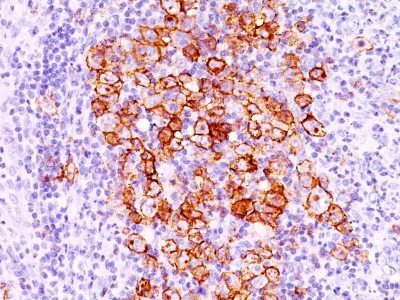 Monoclonal anti CD30 (CD30/412)