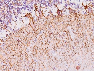 Monoclonal anti Neurofilament (NF H) (NF421)