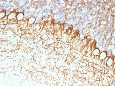 Monoclonal anti Neurofilament (NF H) (RT 97)