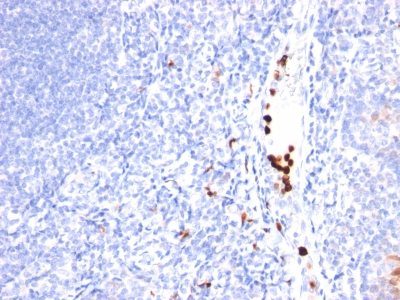 Monoclonal anti CD2 (LFA2/600)