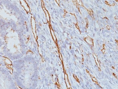 Monoclonal anti CD31 / PECAM 1 (JC/70A)