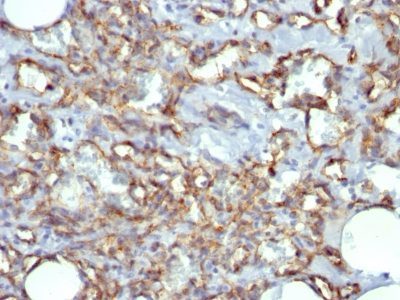 Monoclonal anti CD31 / PECAM 1 (JC/70A)