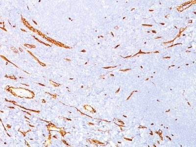Monoclonal anti CD34 (QBEnd/10)