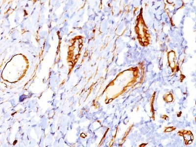Monoclonal anti CD34 (QBEnd/10)