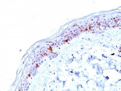 Monoclonal anti CD1a (O10)
