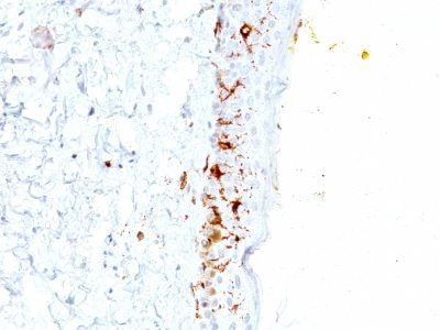Monoclonal anti CD1a (C1A/711)