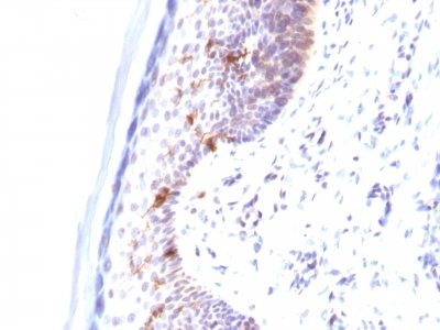 Monoclonal anti CD1a (C1A/711)
