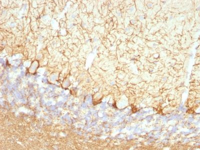 Monoclonal anti Neurofilament (NF L) (NFL/736)