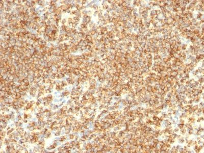 Monoclonal anti CD20 (IGEL/773)