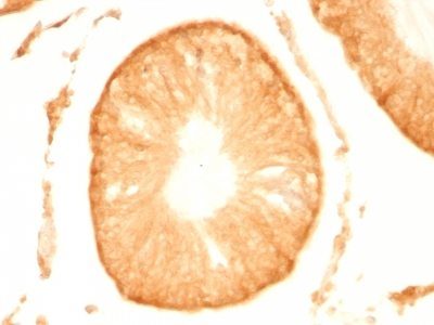 Monoclonal anti pgp9.5 (UCHL 1) (UCHL1/775)