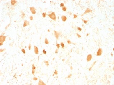 Monoclonal anti pgp9.5 (UCHL 1) (UCHL1/775)