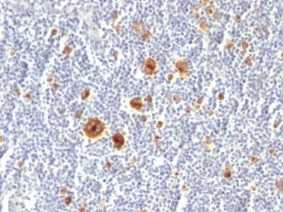Monoclonal anti CD30 (Ki 1/779)