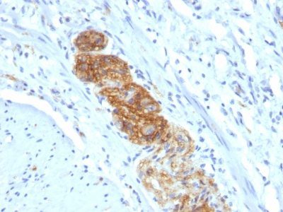 Monoclonal anti CD56 / NCAM (NCAM1/784)