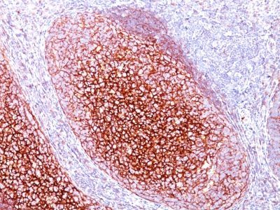Monoclonal anti CD35 / CR1 (CR1/802)