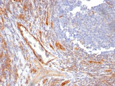Monoclonal anti CD31 / PECAM 1 (C31.10)
