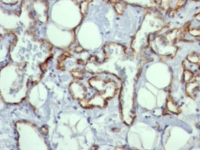 Monoclonal anti CD31 / PECAM 1 (C31.10)