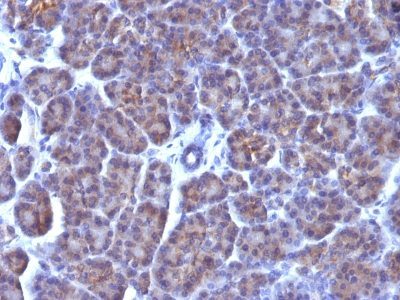 Monoclonal anti Nuclear Membrane (AE 5)