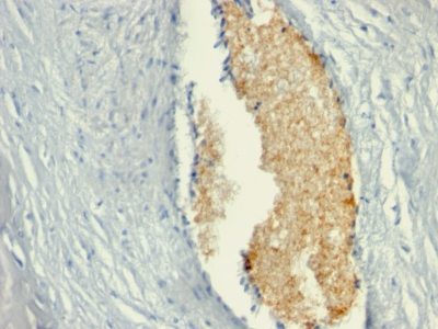 Monoclonal anti Adenosine Monophosphate Deaminase 3 (AMPD3) (AMPD3/901)