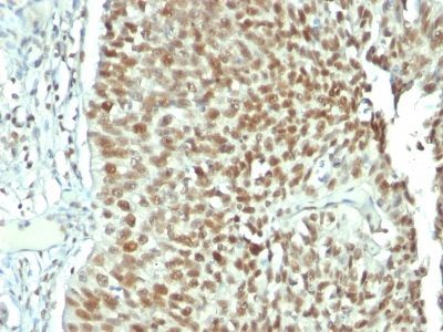 Monoclonal anti Nucleolin (NCL/902)