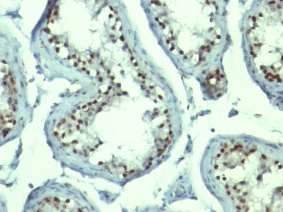 Monoclonal anti Nucleolin (NCL/902)