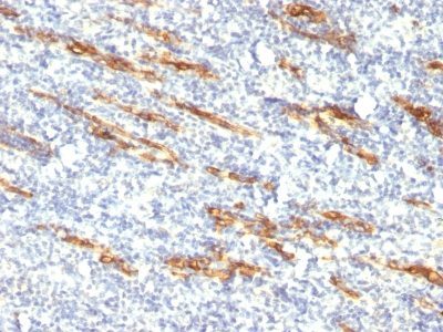Monoclonal anti CD34 (QBEnd/10 + HPCA1/763)