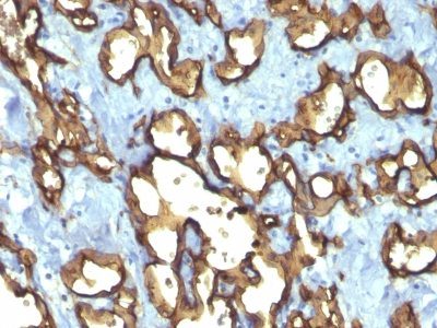 Monoclonal anti CD34 (QBEnd/10 + HPCA1/763)