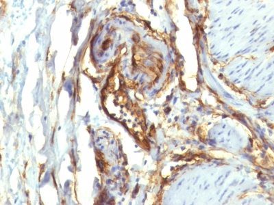 Monoclonal anti CD34 (QBEnd/10 + HPCA1/763)