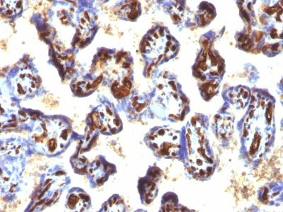 Monoclonal anti CD34 (QBEnd/10 + HPCA1/763)