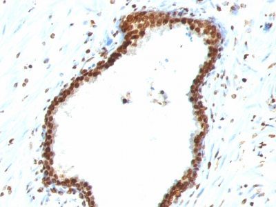 Monoclonal anti Double Stranded DNA (dsDNA) (121 3)