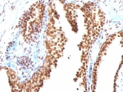 Monoclonal anti Double Stranded DNA (dsDNA) (AE 2)