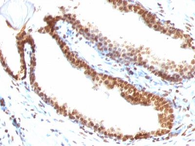 Monoclonal anti Double Stranded DNA (dsDNA) (DSD/958)