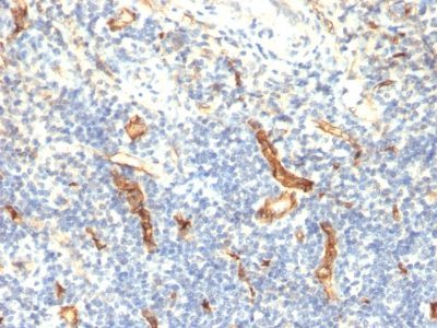 Monoclonal anti CD34 (HPCA1/1171)