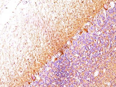 Monoclonal anti Neurofilament (H+L) (RT 97 + NR 4)