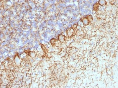 Monoclonal anti Neurofilament (H+L) (RT 97 + NR 4)