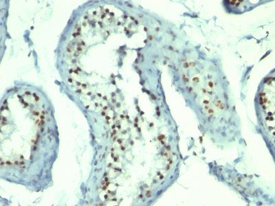 Monoclonal anti Nucleolin (364 5 + NCL/902)