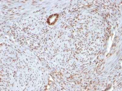 Monoclonal anti Nucleolin (364 5 + NCL/902)