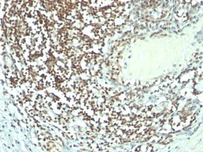 Monoclonal anti Nucleolin (364 5 + NCL/902)